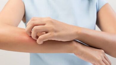 Photo of बदलते मौसम में शरीर पर हो रही है खुजली तो नहाने के पानी में मिलाएं ये चीजें