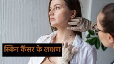 Photo of स्किन कैंसर की ओर इशारा करते हैं त्वचा में होने वाले ये बदलाव