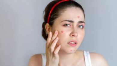 Photo of ये होममेड फेस पैक्स पिंपल्स दूर करने के साथ- साथ चेहरे की चमक भी बढ़ाते हैं