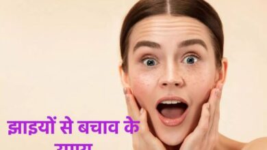 Photo of इन गलतियों से हो सकती है झाइयों की समस्या, बचाव के लिए करें ये उपाय
