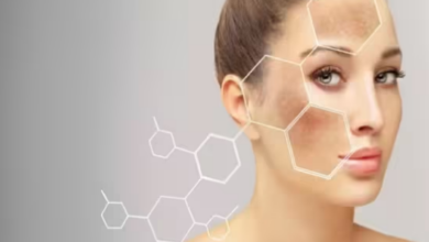 Photo of रैशेज, खुजली के साथ स्किन को और भी कई तरीकों से डैमेज कर सकता है