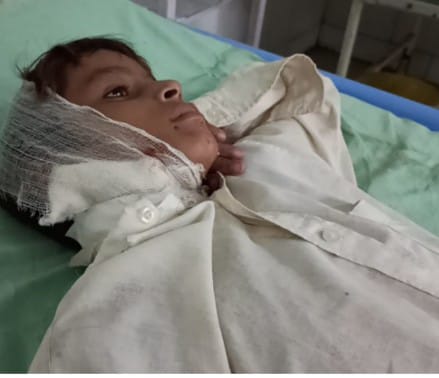 Photo of मुख्यमंत्री के दौरे के 10 घंटे के अंदर फिर भेड़िए ने एक बालक पर किया हमला