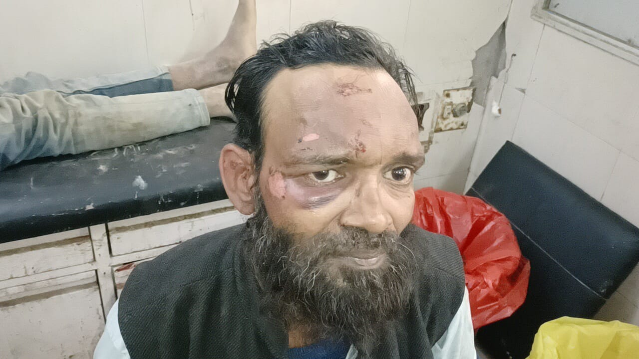 Photo of बहराइच: उधारी लेने गए दुकानदार को श्रमिक ने बुरी तरह पीटा