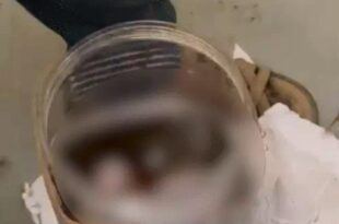 लखनऊ एयरपोर्ट खबर, नवजात का शव कूरियर, केमिकल में डूबा शव, इंदिरा IVF हॉस्पिटल कूरियर, नवी मुंबई कूरियर मामला, लखनऊ एयरपोर्ट जांच, कूरियर एजेंट गिरफ्तार, शव स्कैनिंग में मिला, पुलिस जांच लखनऊ एयरपोर्ट, Lucknow airport news, infant body courier, chemical soaked body, Indira IVF hospital courier, Navi Mumbai courier case, Lucknow airport investigation, courier agent arrested, body detected in scanning, police probe Lucknow airport, लखनऊ एयरपोर्ट पर कूरियर में शव, नवजात शव केमिकल में, इंदिरा IVF कूरियर मामला, एयरपोर्ट पर स्कैनिंग में शव मिला, पुलिस हिरासत में कूरियर एजेंट, Infant body in courier Lucknow, chemical-soaked infant body, Indira IVF courier case, body detected in airport scanning,