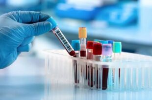 बहराइच लाइफ केयर पैथालोजी, अवैध पैथालोजी सेंटर सील, एसडीएम छापेमारी, नानपारा छापेमारी, एमआरआई सेंटर सील, जीशान खान, बहराइच स्वास्थ्य सुरक्षा, प्रशासन कार्रवाई, अवैध पैथालोजी,