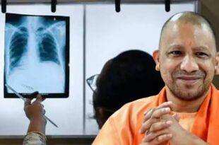 टीबी अभियान, सघन टीबी अभियान, उत्तर प्रदेश टीबी, मुख्यमंत्री योगी आदित्यनाथ, टीबी स्क्रीनिंग, 100 दिवसीय टीबी अभियान, निक्षय शिविर, टीबी मरीज, यूपी में टीबी, क्षय रोग, 35 लाख लोगों की स्क्रीनिंग, स्वास्थ्य जागरूकता, TB Campaign, UP TB Campaign, TB screening, TB patients, Uttar Pradesh TB initiative, TB elimination, TB awareness, Nikshay Camp, TB awareness campaign, TB in UP, Chief Minister Yogi Adityanath,सघन टीबी अभियान यूपी, टीबी मरीजों की जांच, टीबी स्क्रीनिंग शिविर, निक्षय शिविर, योगी आदित्यनाथ टीबी अभियान, टीबी जागरूकता अभियान, टीबी उन्मूलन, स्वास्थ्य सेवाएं यूपी, TB Campaign UP, TB screening camps, TB patient identification, Nikshay camp UP, TB awareness in UP, TB elimination campaign, TB treatment in Uttar Pradesh,