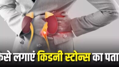 Photo of किडनी में पथरी क्यों हो जाती है और इससे आप कैसे खुद को बचा सकते हैं