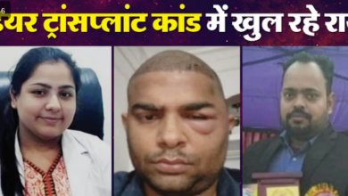 Photo of दांतों की डॉक्टर ने 40 हजार में किए थे हेयर ट्रांसप्लांट… ये काम करने का किया था दावा; एक और नया खुलासा