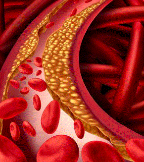 Photo of चुपके-चुपके आपका Cholesterol बढ़ा रहे हैं 5 Foods