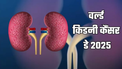 Photo of कहीं आपकी लाइफस्टाइल ही तो नहीं किडनी कैंसर की वजह? जानिए बड़े कारण
