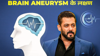Photo of क्या है Brain Aneurysm, जिससे जूझ रहे हैं बॉलीवुड एक्टर Salman Khan