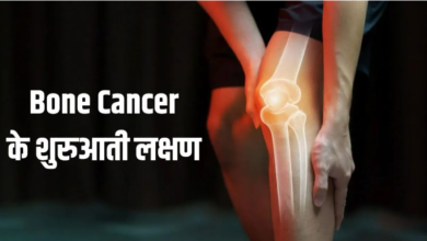 Photo of ये 5 लक्षण दिखें तो समझ जाएं हो गया है Bone Cancer, समय रहते नहीं दिया ध्यान तो पड़ जाएंगे लेने के देने