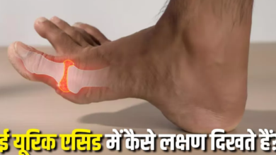 Photo of सिर्फ रात में दिखाई देते हैं यूरिक एसिड बढ़ने के ये 4 लक्षण