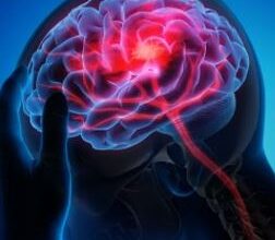 Photo of ब्रेन स्ट्रोक आने से पहले शरीर में दिखते हैं ये 6 संकेत