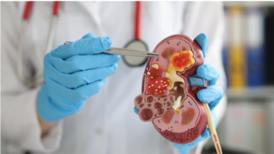 Photo of किडनी को हेल्दी रखने के लिए बस करने होंगे 5 काम
