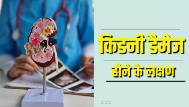 Photo of किडनी खराब होने के इन शुरुआती संकेतों को न करें इग्नोर