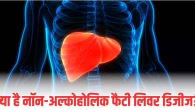 Photo of शराब नहीं पीते हैं? फ‍िर भी हो सकता है Fatty Liver; जानें क्‍यों साइलेंट क‍िलर बन रही ये बीमारी