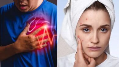 Photo of स्किन पर नजर आएं ये 5 लक्षण ताे समझ जाएं बीमार हो गया है आपका Heart