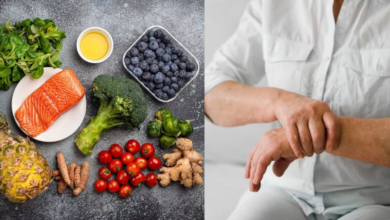 Photo of Arthritis के मरीजों का कैसा हो खानपान? जानें क्‍या खाएं-क्‍या नहीं; ताक‍ि कंट्रोल में रहे Uric Acid
