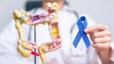 Photo of खराब लाइफस्टाइल से बढ़ाती है कोलन कैंसर का जोखिम