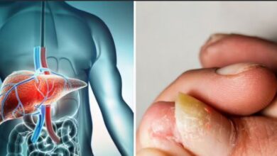 Photo of पैरों में नजर आते हैं लिवर डैमेज के एक नहीं 8 लक्षण
