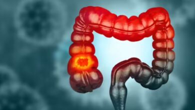 Photo of शुरुआती स्टेज में मुश्किल होता है प्रोस्टेट कैंसर का पता लगाना
