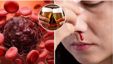 Photo of उम्र, स्मोकिंग या लाइफस्‍टाइल, किन वजहों से बढ़ता है  ब्लड कैंसर का खतरा