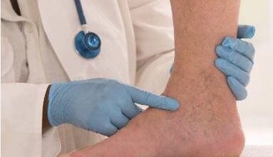 Photo of पैरों में दिखते हैं खराब ब्लड सर्कुलेशन के ये 3 लक्षण